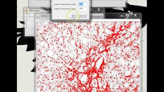 Quantifying Stained Liver Tissue Area Using ImageJ [upl. by Fontana]