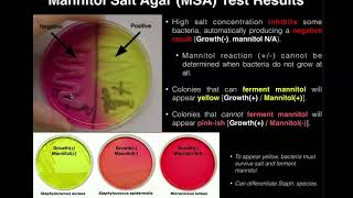 Mannitol Salt Agar MSA  Results amp Theory [upl. by Amir649]