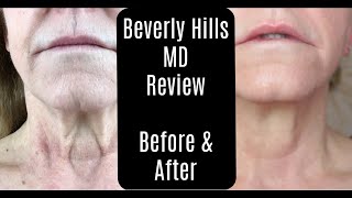 Beverly Hills MD Dermal Repair Complex—Lift and Firm Sculpting Cream—Before and After—AntiAging [upl. by Hayidan]