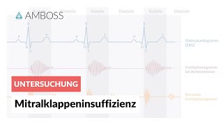 Mitralklappeninsuffizienz  Herzgeräusch  AMBOSS Video [upl. by Lucius551]