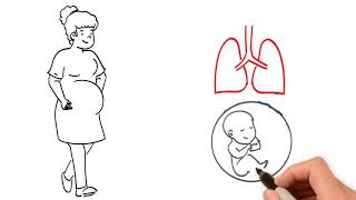 Pregnancy and the Respiratory System [upl. by Zasuwa672]