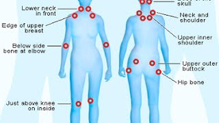 Counterstrain and Facilitated Positional Release [upl. by Stets]