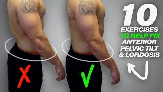 10 Exercises to Help Fix Anterior Pelvic Tilt amp Lordosis [upl. by Ttirrej]