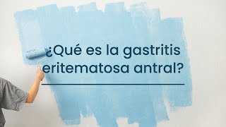 ¿Qué es la Gastritis eritematosa antral [upl. by Sebastiano]