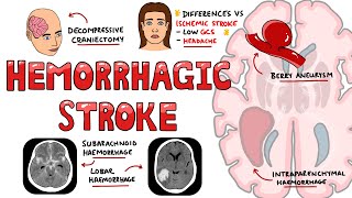 Normal Head CT Scan Anatomy Made Simple Neuroradiology [upl. by Just]