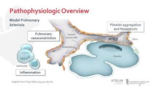 A Focus Series on Hypertension Pathophysiology [upl. by Aminta840]