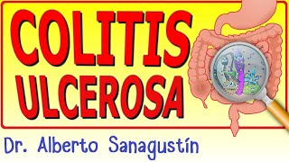 COLITIS ULCEROSA explicada fácil [upl. by Acisseg]