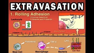 EXTRAVASATION [upl. by Hnacogn]