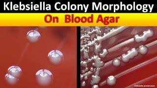 Klebsiella Colony Morphology On Blood Agar [upl. by Aiveneg]