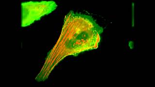 Plasma membrane ruffling vizualised with Actin RFP and Plasma membrane GFP [upl. by Norit]