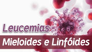 IMMUNOCAL  Leucemia Linfoblástica Aguda [upl. by Katheryn172]