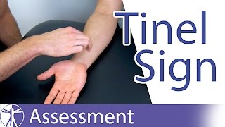 Tinel Sign Wrist  Carpal Tunnel Syndrome Diagnosis [upl. by Swisher]