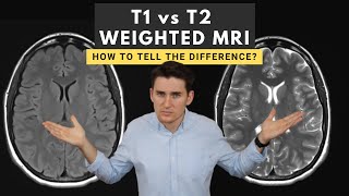 T1 vs T2 weighted MRI images How to tell the difference [upl. by Joab]