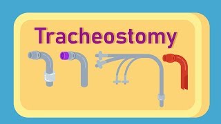 What is Tracheostomy [upl. by Hurd104]