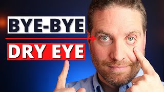 How To Get Rid Of Dry Eyes  4 Advanced Home Treatments [upl. by Lemmueu]