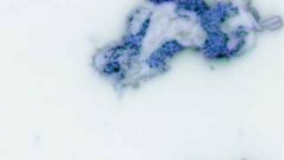 Phagocytosis White blood cell Shigella bacteria Live movie [upl. by Werbel]