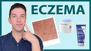 Eczema How to Treat amp Get Rid of It [upl. by Enived]