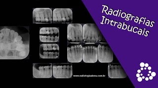 EXAME  Radiografias Intrabucais  Radiologia Odontológica Abreu [upl. by Bing642]