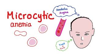 Microcytic Anemia introduction [upl. by Siuoleoj279]