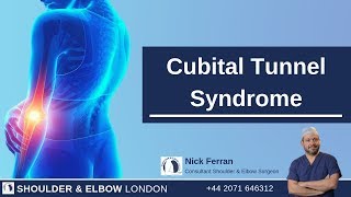 Cubital Tunnel Syndrome Surgery [upl. by Nylesoj358]