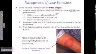 Lyme disease by borrelia [upl. by Roanne]