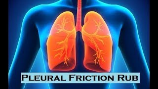 Pulmonary Sounds  Pleural Friction Rub [upl. by Alejoa162]