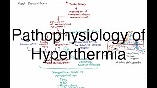 Hyperthermia Pathophysiology [upl. by Shiller946]