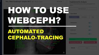 How to use WEBCEPH Automated Cephalometric Tracing [upl. by Akehs243]