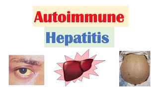 Autoimmune Hepatitis  Pathogenesis Signs amp Symptoms Diagnosis Treatment [upl. by Mallis657]