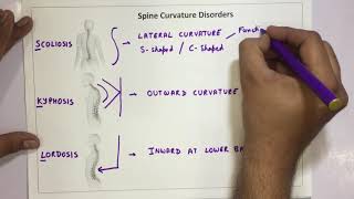 Spine Curvature Disorders  Scoliosis Kyphosis Lordosis [upl. by Yerdna864]