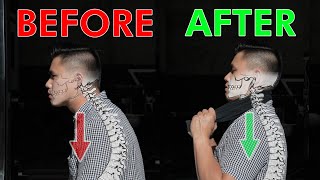 Restore Your Neck Posture amp Curve  Cervical Lordosis [upl. by Belloir]