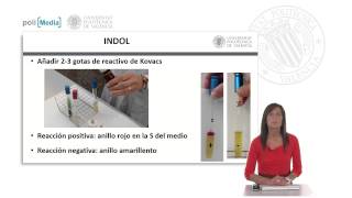 IMVIC Indol Rojo de metilo VogesProskauer Citrato   UPV [upl. by Anitsirk]