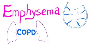 Respiratory  Spirometry Lung Volumes amp Capacities [upl. by Ellenhoj]