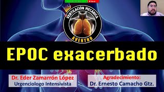 EPOC Exacerbado [upl. by Ahtivak880]