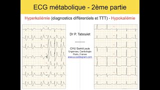 12b ECG métabolique 2 Hyperkaliémie et Hypokaliémie Dr Taboulet [upl. by Gnim]