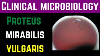 Proteus Mirabilis amp Vulgaris ClinicalPathogenesisInvestigationTreatmentPrevention  Dr Mubashar [upl. by Annelise]