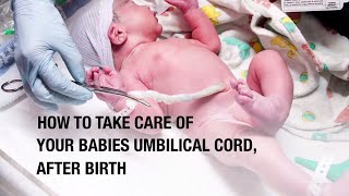 How to take care of your babies umbilical cord after birth [upl. by Aelem]