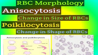 RBC MORPHOLOGY What is Anisocytosis What is Poikilocytosis [upl. by Ytirehc]