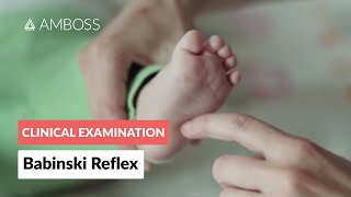 Babinski Reflex in Infants  Clinical Examination [upl. by Aztin]