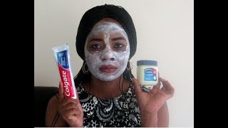 I applied colgate toothpaste amp vaseline on my face this is what happened after [upl. by Willtrude]