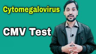 CMV Test  Cytomegalovirus Test [upl. by Nnarual668]