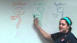 Scoliosis Lordosis and Kyphosis [upl. by Berglund575]