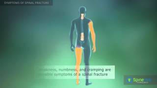 Spinal fracture Symptoms [upl. by Bruis610]