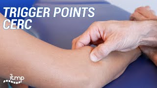 Trigger point du CERC Court extenseur radial du carpe [upl. by Aislehc]