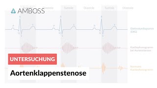 Aortenklappenstenose  Herzgeräusch  AMBOSS Video [upl. by Llevad52]