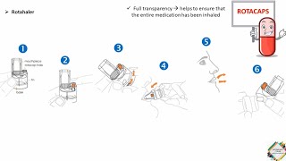 INHALERS TYPES amp HOW TO USE [upl. by Aniaj869]