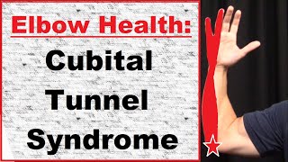 Elbow Cubital Tunnel Syndrome [upl. by Ojillib]