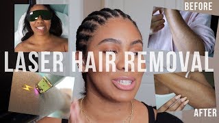 Laser Hair Removal Things To Know  Before amp After  zoerudd [upl. by Euqinemod5]