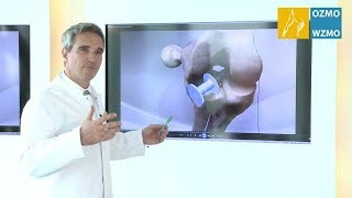 Prof Dr Diehl Kreuzband  Ursache Kreuzbandriss amp minimalinvasive Versorgungsmöglichkeiten [upl. by Prady]