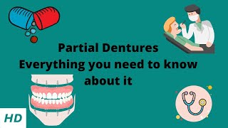 PARTIAL DENTURE Everything you need to know about them [upl. by Hubey761]